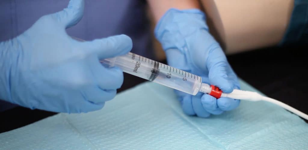 Addressing Dehydration in Nursing Homes The Macy Catheter