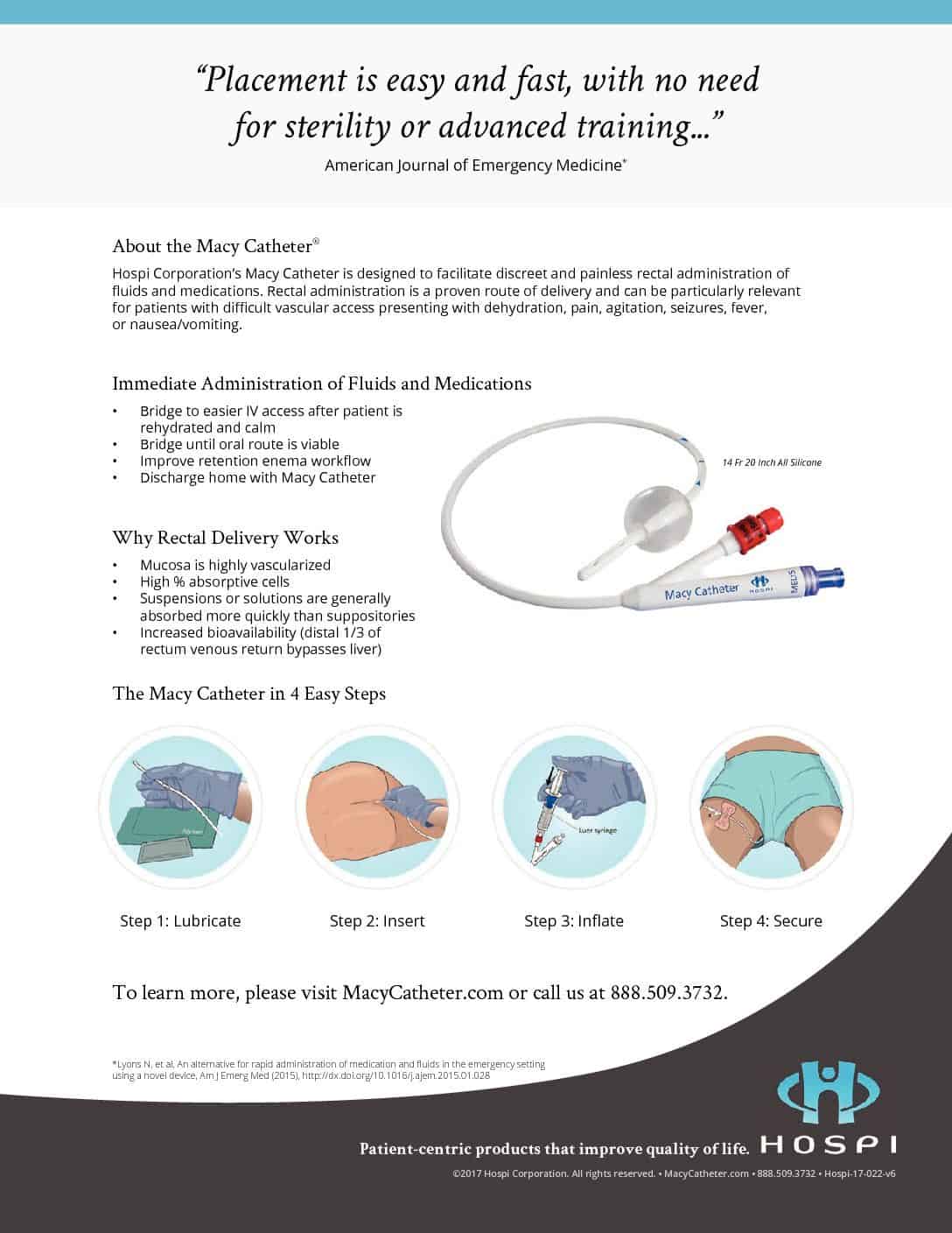 Product Info The Macy Catheter