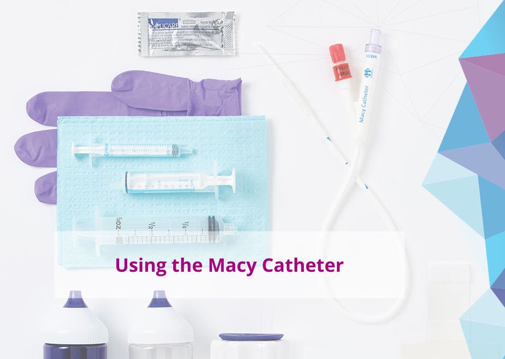 How to Administer Medication with the Macy Catheter Macy Catheter